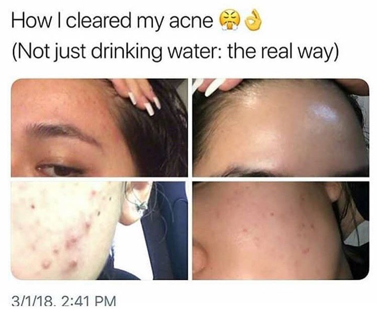 Skin care thread